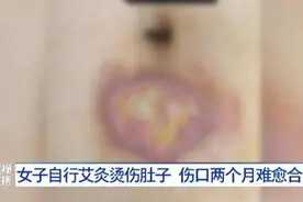 女子被烫出水泡，伤口两个月难愈合！气温下降，小心低温烫伤→图片