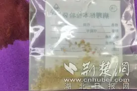 “犟”阿姨听信朋友“建议” 结石拒做手术“硬扛”三年 医生巧用微创解困扰图片
