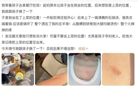 别再抹牙膏、酱油、白酒了!烫伤急救“五字诀”了解一下→图片