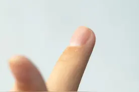 长了倒刺到底是“缺”哪种维生素？很多人都被误导了！正确的答案是→图片