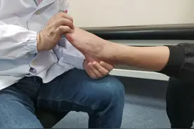 留意！双脚出现5个表现，多半是血糖超标了！图片