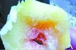 紧急提醒：不要吃！已进入高峰期，没有特效药图片