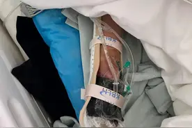 过年前，有孩子手被炸伤！快管住！图片