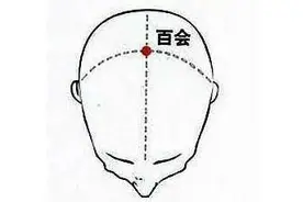 头痛头晕、情绪低落，中医推荐多按压头顶这个穴位图片