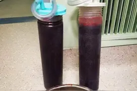 生死时速见真功！石岛人民医院成功抢救一名迟发脾破裂大出血患者图片