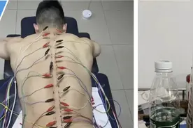 心疼……石智勇扎过的针，装满5升水桶！图片