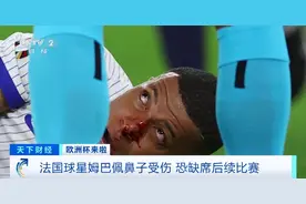 鼻子出现变形！法国球星姆巴佩鼻子受伤，恐缺席对战荷兰队图片