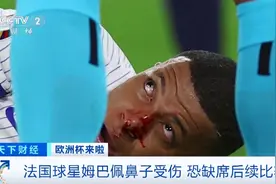 鼻子出现变形！法国球星姆巴佩鼻子受伤，恐缺席对战荷兰队图片