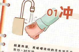春节期间，谨防儿童烧烫伤！这些防范和处理方法家长务必牢记！图片