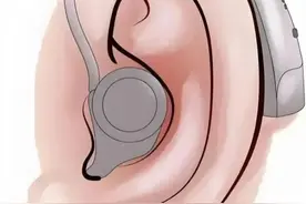 爱耳日｜助听器还有好几种？怎么选→图片