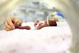 仅在妈妈肚子里待了181天 医护人员近90天的日夜守护 860克“巴掌宝宝”成功闯关出院图片