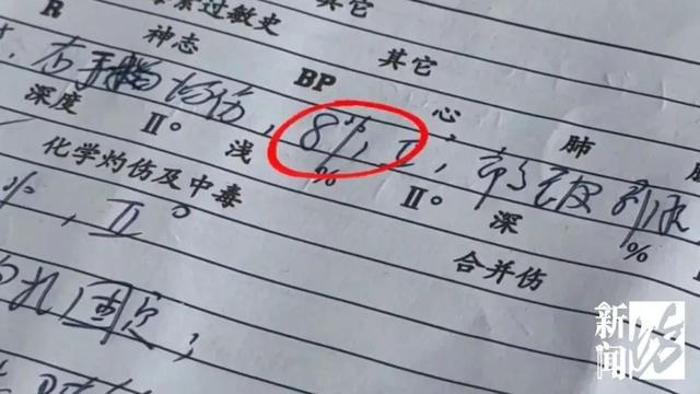 把手断裂 火锅店整壶高汤浇母女身上