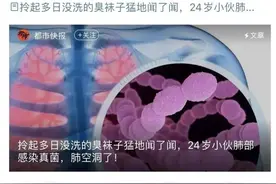 科普|闻臭袜子竟然肺部感染？这个习惯一定要改图片