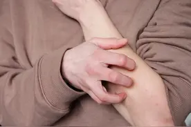 明明以前不过敏，为什么现在突然过敏了？多年困惑终于解开图片