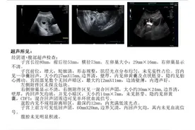 腹中双胎“分房住”，新兴县人民医院成功急救孕妇图片