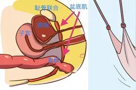 健康科普丨盆底肌的那些事儿，滕州市中心人民医院为您全面解读！图片