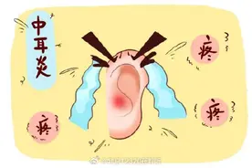 急性化脓性中耳炎的临床表现有哪些？图片