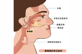 体检新招式：鼻咽癌早期筛查，让你的健康不留死角！图片