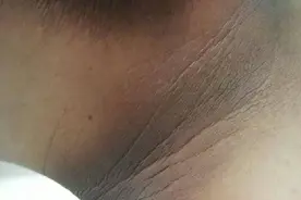 脖子“洗不干净”，或是身体发出危险信号图片