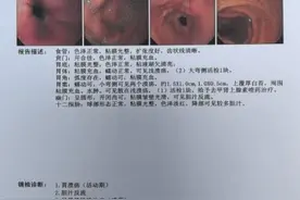 八岁男童呕血、黑便，原因居然是……图片