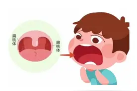 鼻塞流涕不一定是感冒，还可能是这种病图片