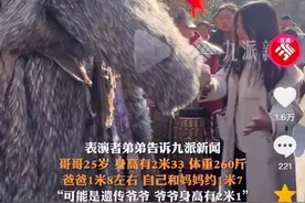 万岁山景区回应巨人演员走红，医生：巨人症需早发现早治疗图片