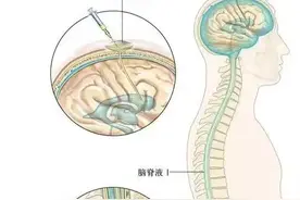 郴州市第一人民医院多学科协作攻克晚期肿瘤并发症图片
