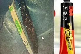 女子误吞“502”，一年后竟还在肚子里！图片