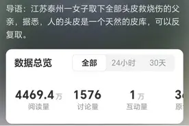 22岁女子为救父亲取下全部头皮！当事人发声图片
