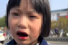 女童哭诉被7名同学打得满嘴血，父亲称不追究责任，律师：需考虑女童和其他监护人意见图片