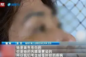 毒性是砒霜的68倍！女子吃完险丧命！家里常见图片