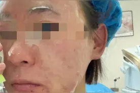 打针后，突发休克！要警惕！图片