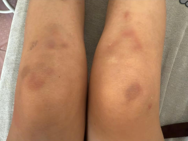 女子称因工资问题被老板锁办公室殴打