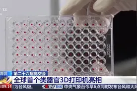 大开眼界！3D打印机能打印器官了?图片