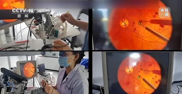 远程机器人手术，离“实用”还有多远