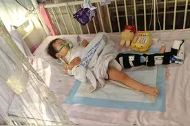 本以为是滑膜炎，没想到是这种病！日照2岁男娃急盼救助！图片