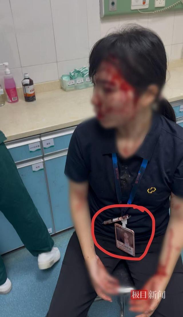 男子持水杯砸伤女同事被刑拘后续