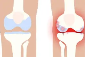 3个动作，延长膝盖“寿命”图片