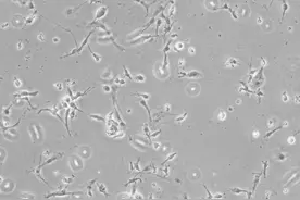 追问｜科学家如何发现或能治疗自闭症的新药物分子？图片