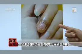 快过年了！这3个爱美行为，可能损伤肝肾、惹来癌症！已经有人中招了图片