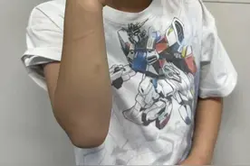 3岁男孩一个踉跄，被妈妈一把拉回后手臂不能动了！医生：这些动作，高危！图片