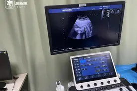 现金交易不开票，购买器械无资质？揭秘违规胎儿性别鉴定背后市场图片