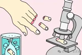 手指离断，我们能做些什么呢？图片