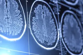 从女儿变成“妈妈的妈妈”，是母亲确诊阿尔茨海默病后，我的人生唯一选项图片