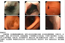 易腐蚀器官！浙江女子醒来喉咙像火烧！网友：每天都在做图片