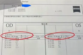 眼科专家揭秘：佩戴角膜塑形镜需注意！图片