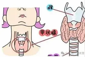 肚子总“闹别扭”？甲状腺可能是幕后黑手！图片