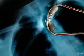 3天空调吹出“白肺”！高温来了，这个细节要当心图片