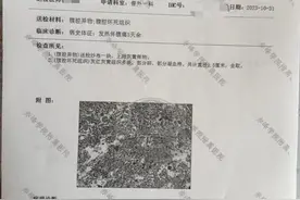 赤峰一男子阑尾炎手术15个月后在体内发现纱布，当地医调委已介入图片