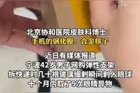 碰一次要痒几年！这些产品家里有的赶紧换了图片